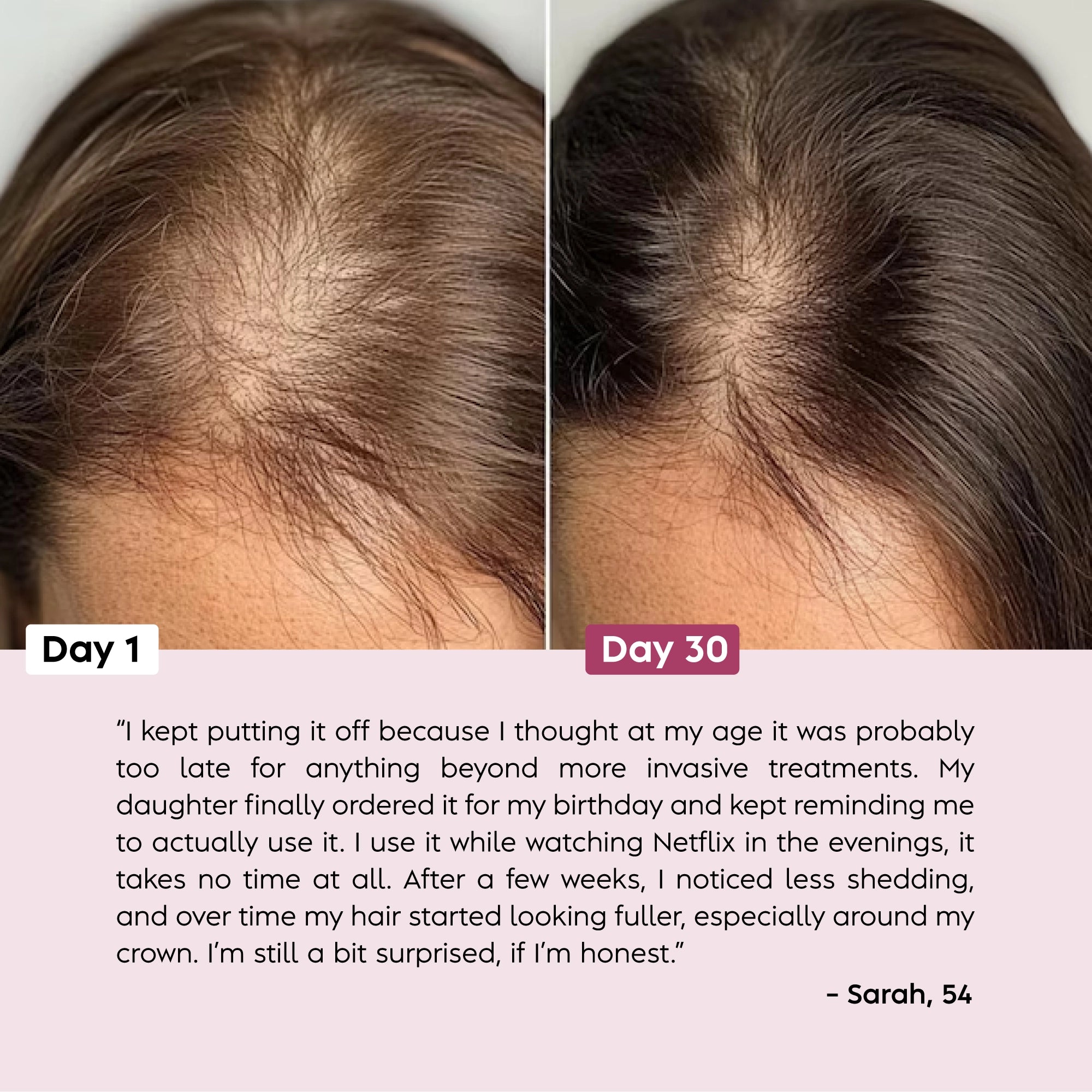 Scalpistry™ Scalp & Hair Growth Therapy Comb